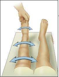 Log roll en sinovitis transitoria