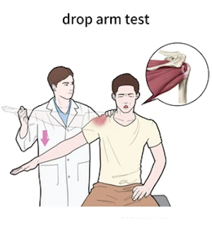 Drop Arm Test