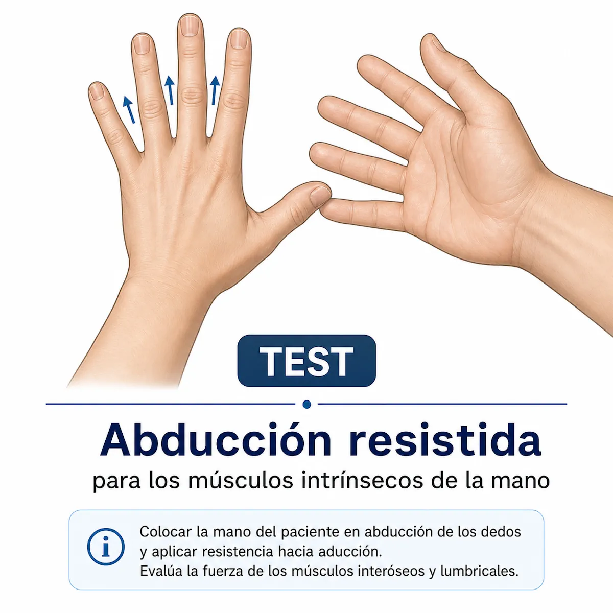 Prueba de abducción resistida