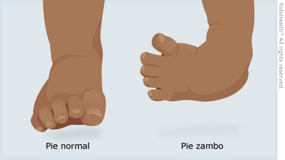 pie zambo