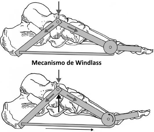 Windlass invertido y rotura de la placa plantar