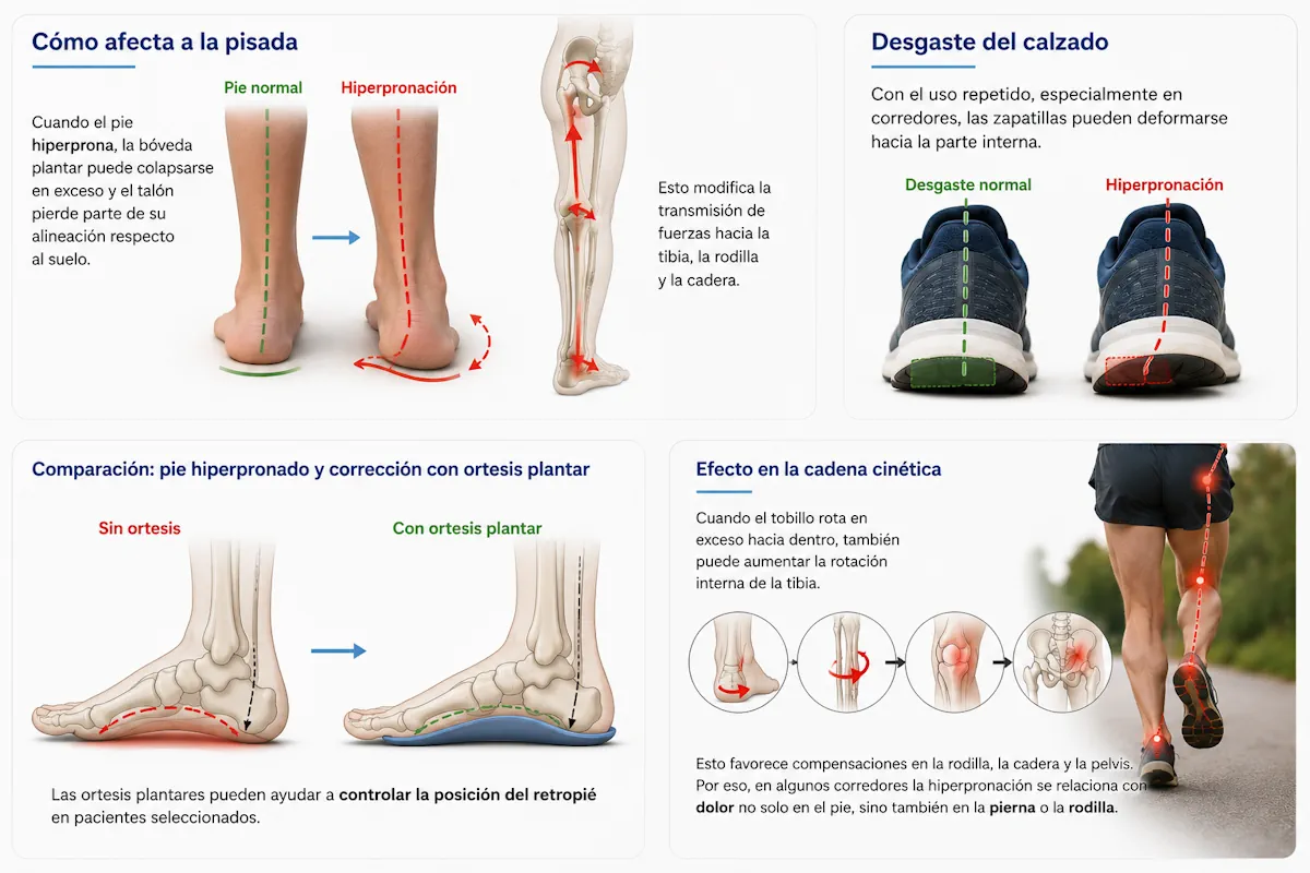 Comparación de pie hiperpronado y corrección con ortesis plantar