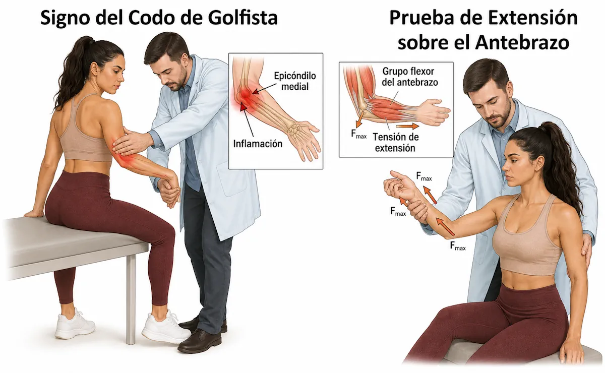 Pruebas clínicas de epitrocleitis