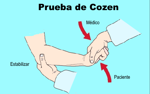 Test de Cozen