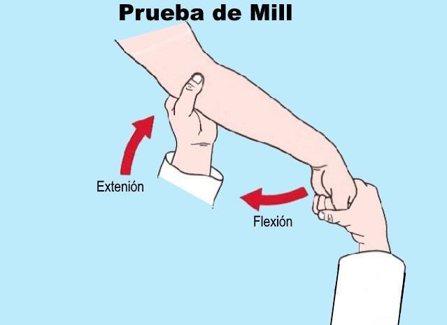 Test de Mill