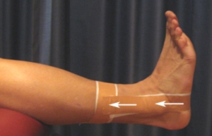 Taping y soporte en fase de rehabilitación