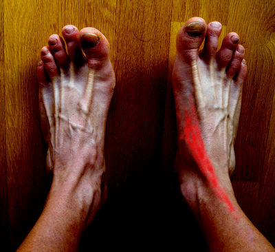 Músculo Tibial Anterior