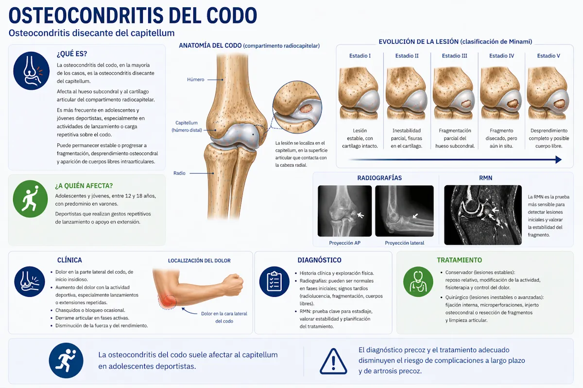 Osteocondritis del codo en el compartimento radiocapitelar