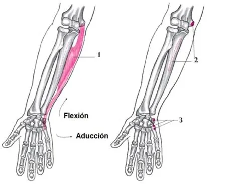 Tendinitis del cubital anterior en el codo