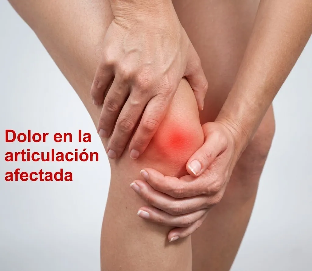 Imagen radiológica de artrosis