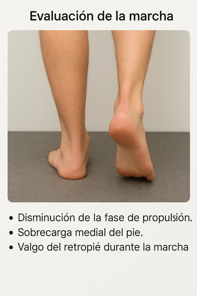 Análisis de la marcha en la insuficiencia del tibial posterior